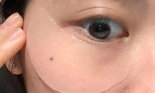 眼袋