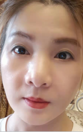 眼袋