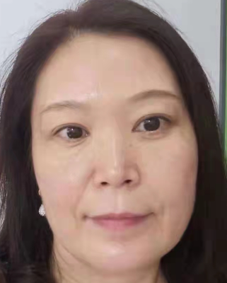 眼袋