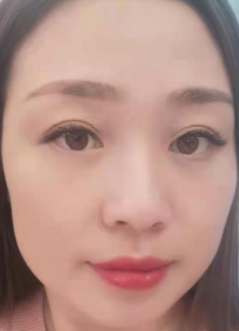 眼袋