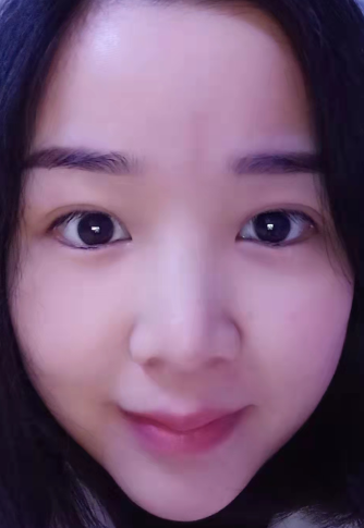 眼袋