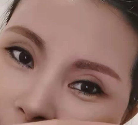 眼袋