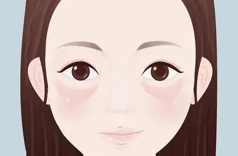 眼袋