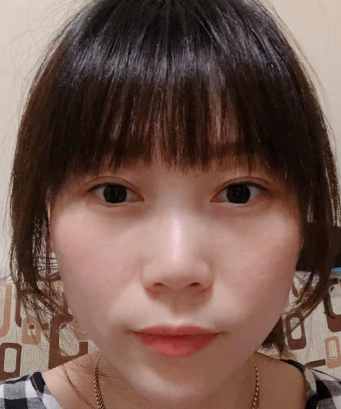 眼袋