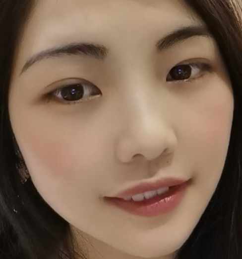 眼袋