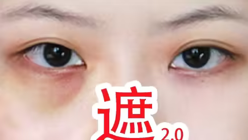 去眼袋手术