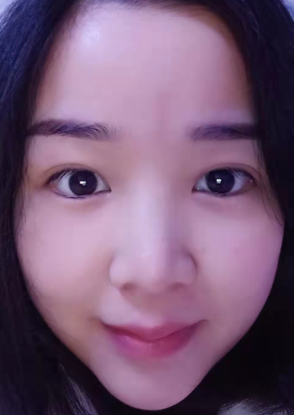 眼袋