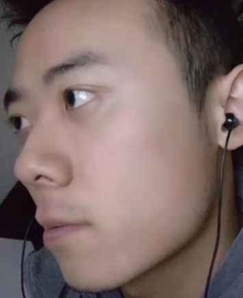 眼袋