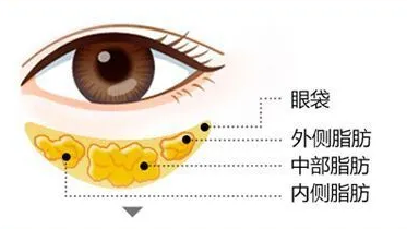 眼袋