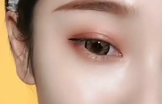 眼袋
