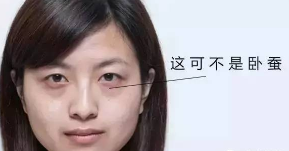 眼袋