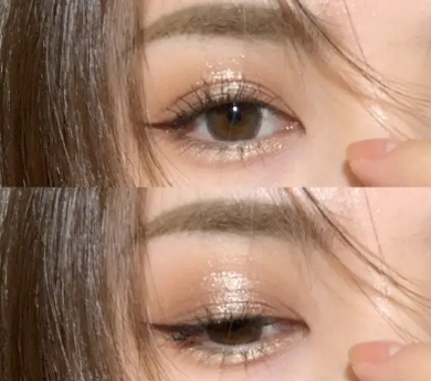眼袋