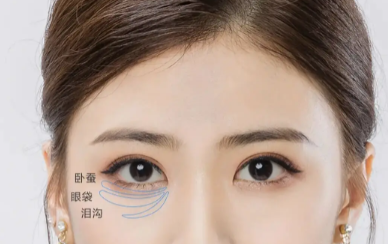 眼袋