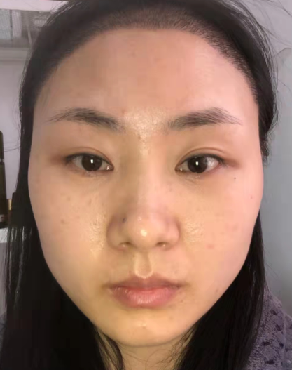 眼袋