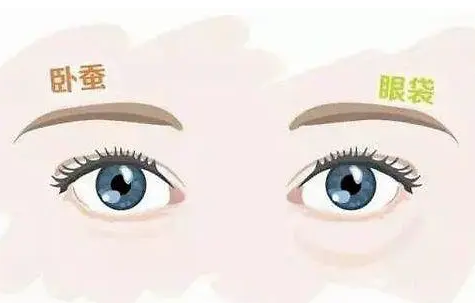眼袋