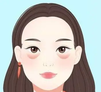 眼袋