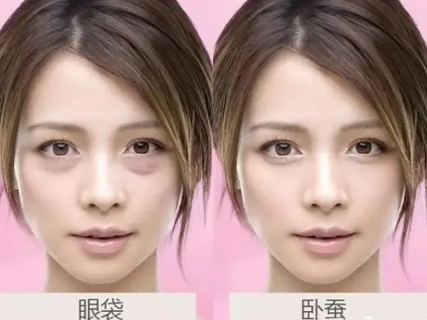 眼袋