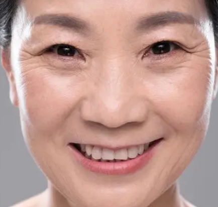 去眼袋手术