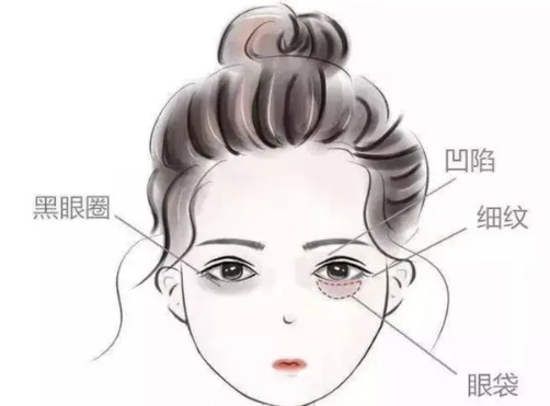 眼袋