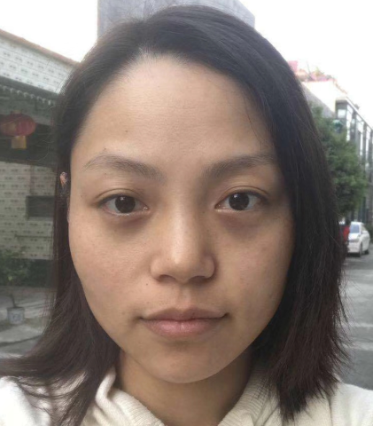 眼袋