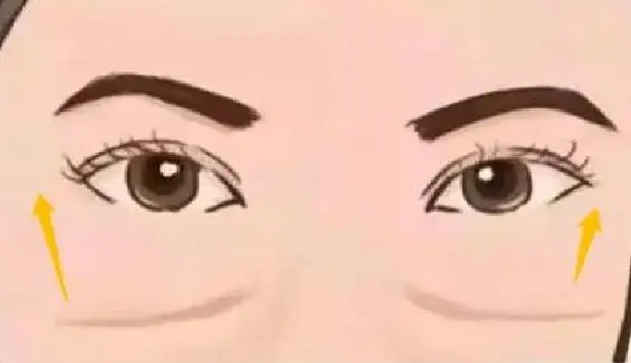 眼袋