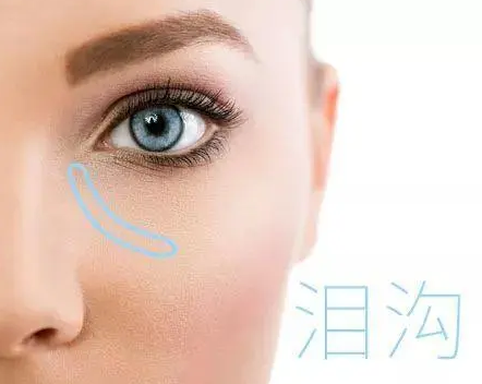 眼袋
