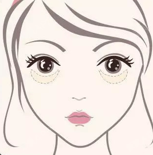 眼袋