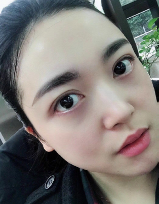 眼袋