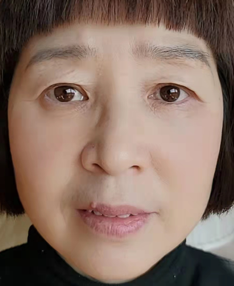 泪沟