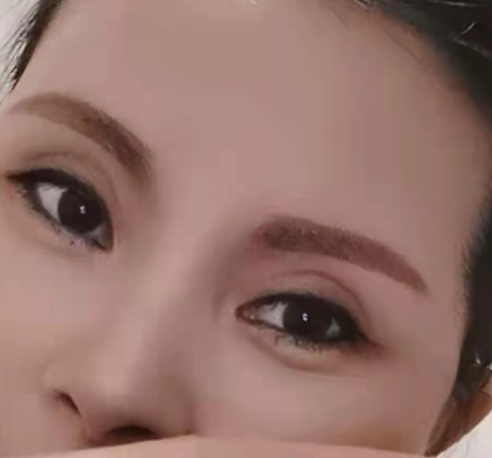 眼袋