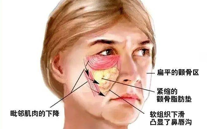 眼袋