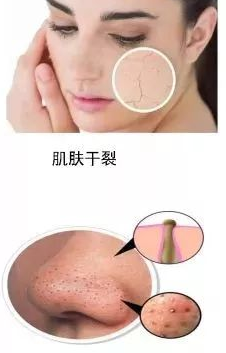 皮肤