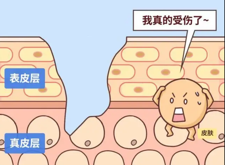 自体脂肪丰胸
