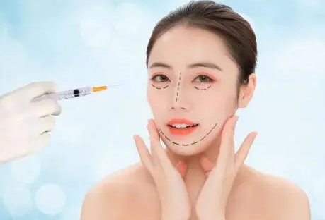 自体脂肪填充