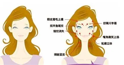 自体脂肪填充
