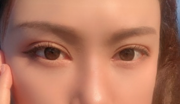 眼袋