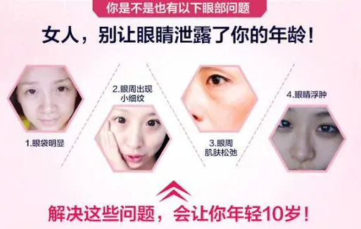 眼袋