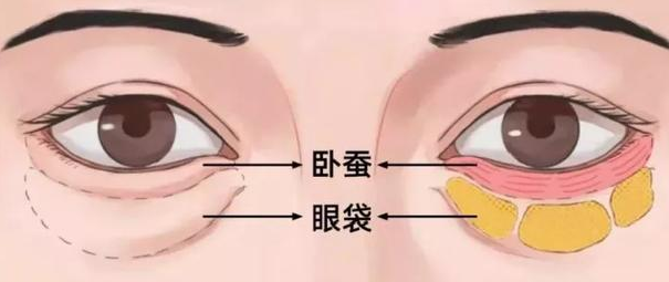眼袋