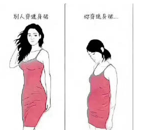 自体脂肪丰胸