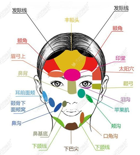 自体脂肪填充
