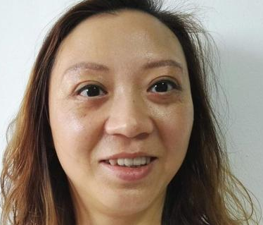 去眼袋手术