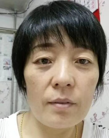 眼袋