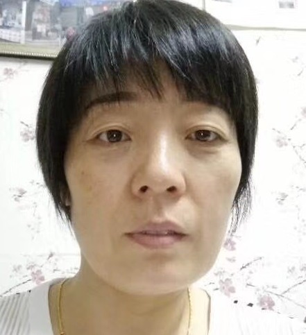 眼袋