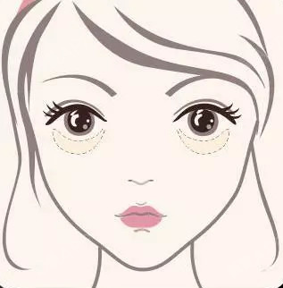 眼袋
