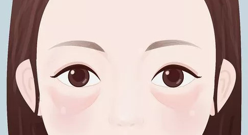 眼袋
