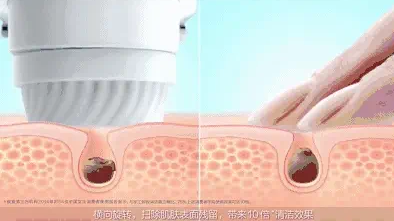 皮肤