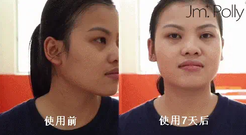肌肤