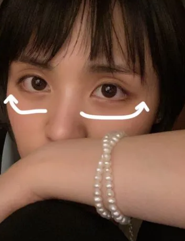 眼袋