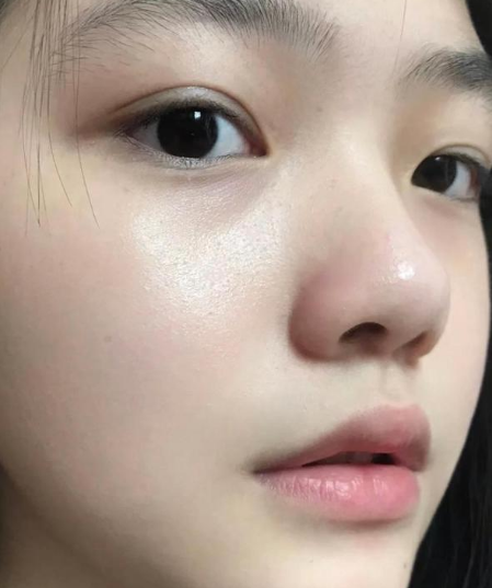 皮肤