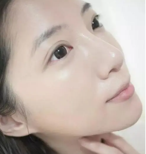 皮肤